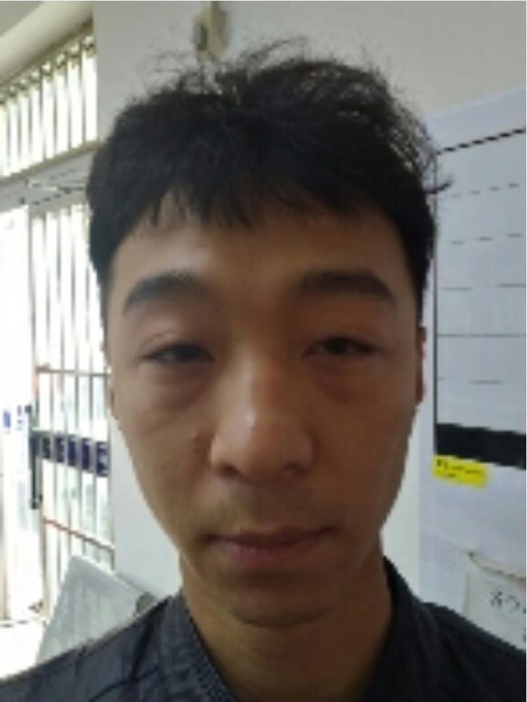 Zhang Pengcheng